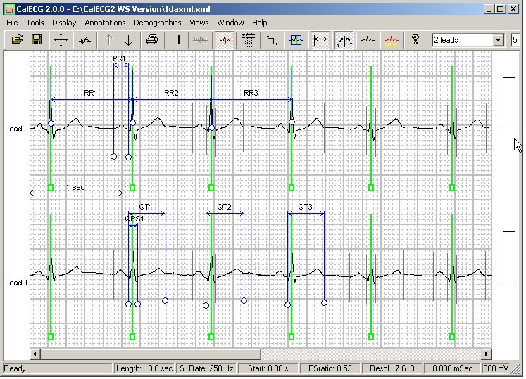 Software Tools for Resting ECG